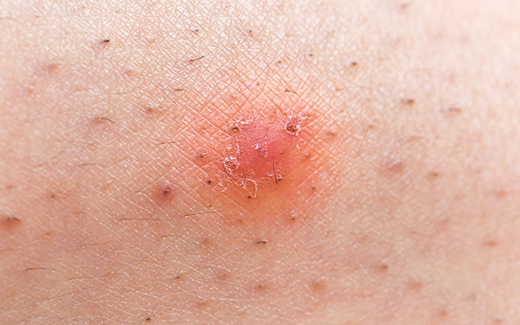 Rekomendasi Produk untuk Mengatasi Ingrown Hair yang Paling Ampuh | Jasa Maklon Hair Care Terbaik dan Terpercaya di Jakarta dan Tangerang | Sinar Alfa Omegax